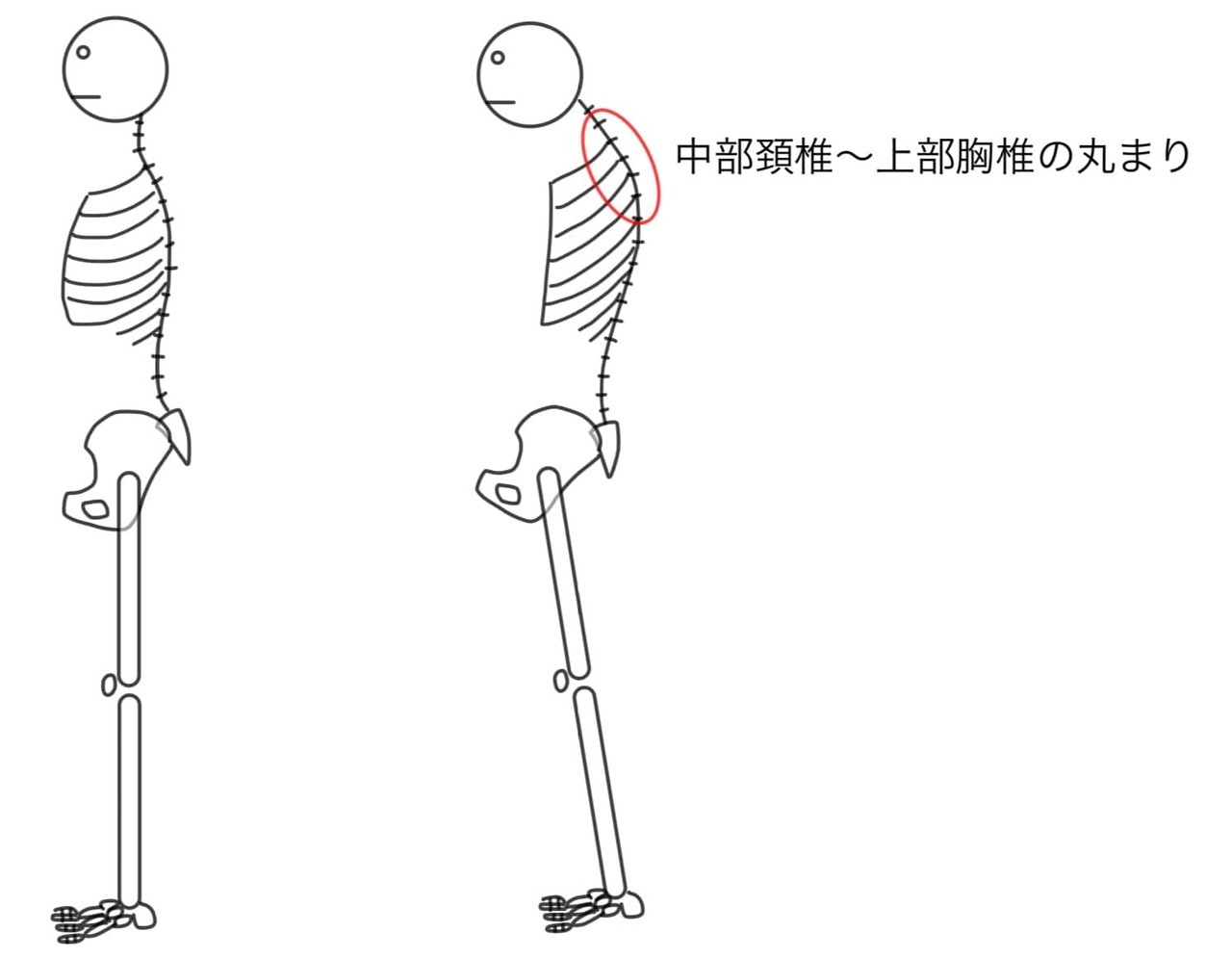 【市川整体院】ストレートネック｜猫背姿勢による立位頚椎バランス.jpg