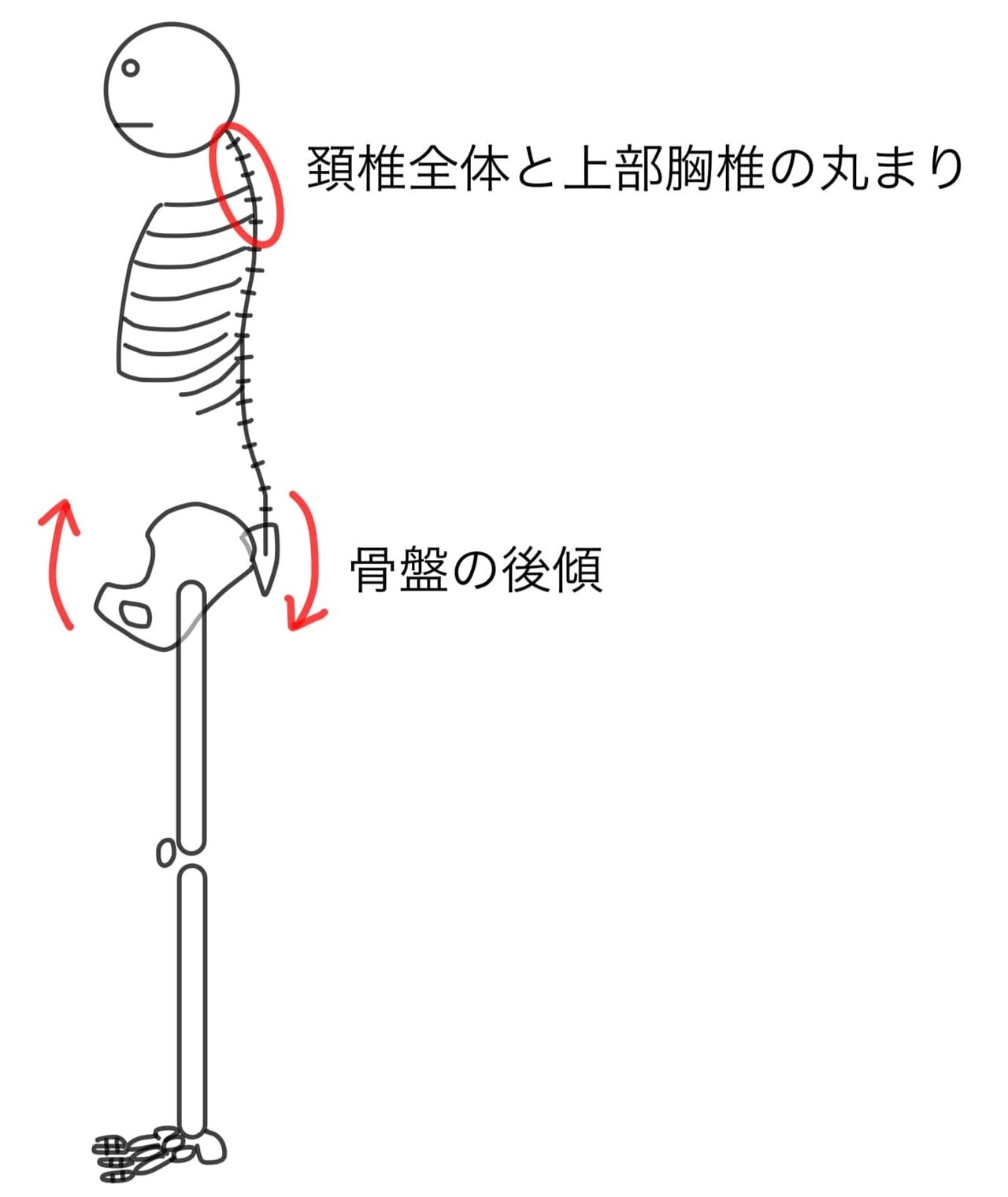 【市川整体院】ストレートネック｜骨盤後傾位によるストレートネックの立位バランス.jpg